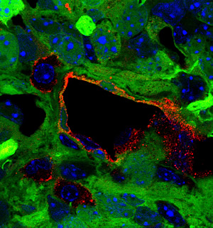 Glioblastoma tumor cells