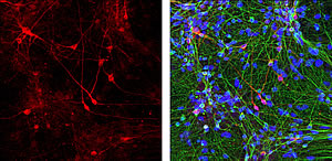 dopaminergic neurons