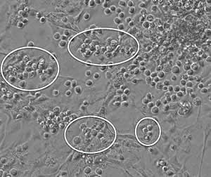 hematopoietic cells