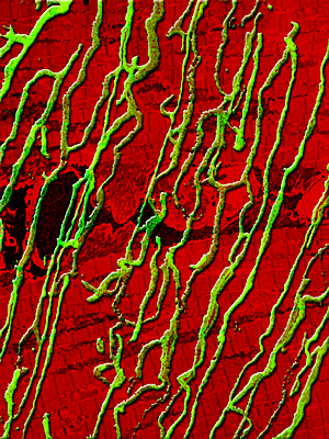 Genetic enhancement of skeletal muscle blood supply