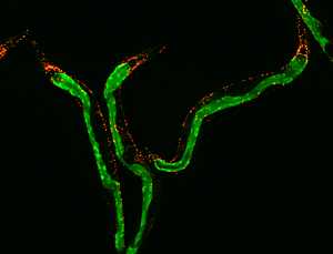 mitochondria