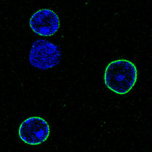 extremely long-lived proteins