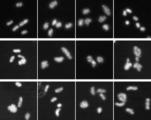 chromosomes found in a normal roundworm