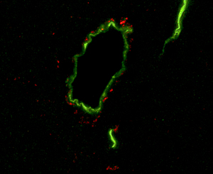 immature nerve cells