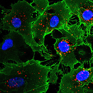 Endothelial cells