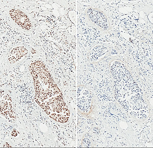 chemotherapeutic drugs and cellular stress