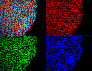 pluripotent stem cells