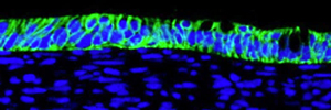 epithelial cells