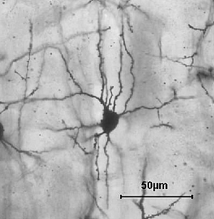 Spiny stellate cell