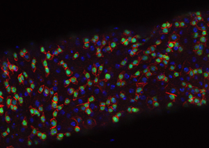 intestinal stem cells