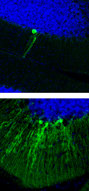 Cerebellum