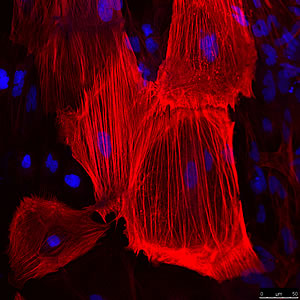 Cord blood-derived iPS cells