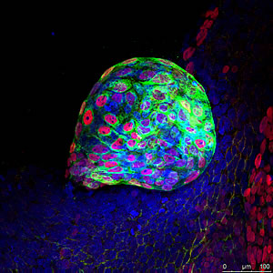 Cord blood-derived iPS cells