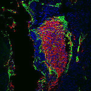 Downregulating p53