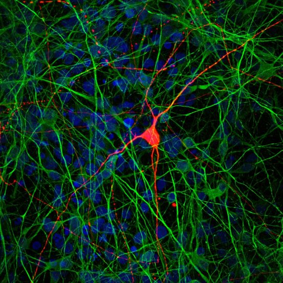 Interconnected cells-in-a-dish let researchers study brain disease ...