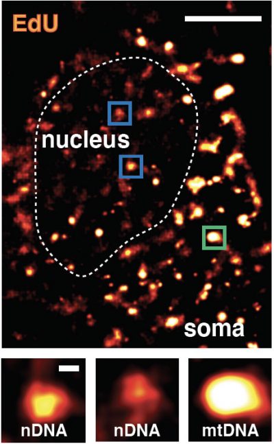 How Brain Cells Repair Their Dna Reveals “hot Spots” Of Aging And Disease Salk Institute For