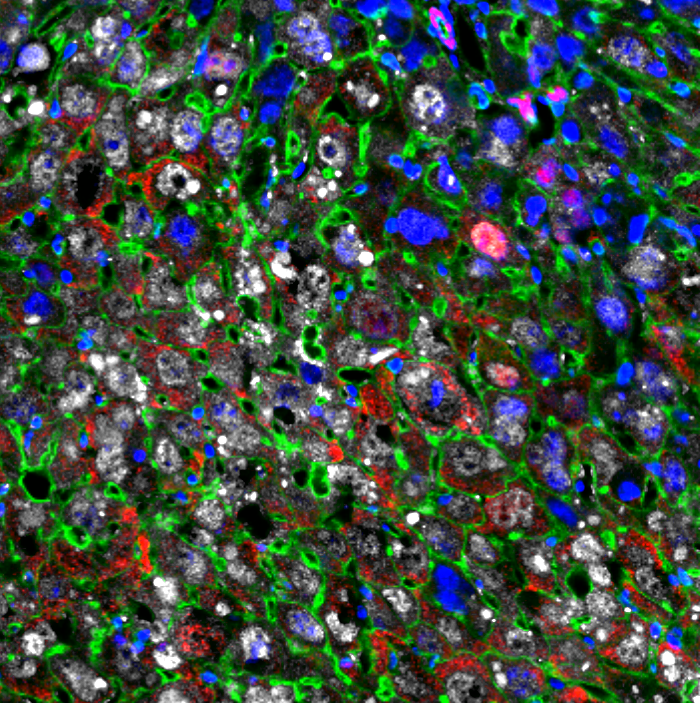 Cellular regeneration therapy restores damaged liver tissue faster
