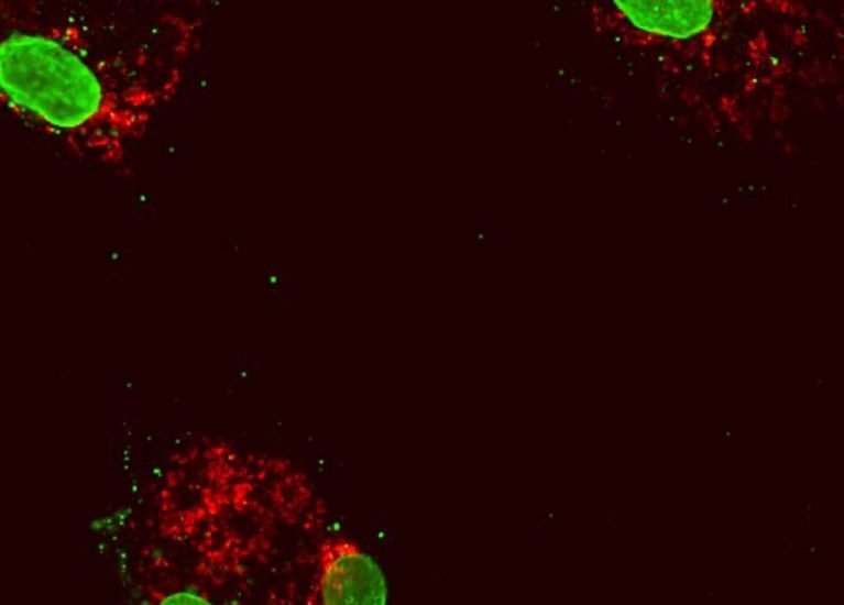 Human blood cells following reduced expression of the gene DNMT3A. The cell nuclei (large green structures) inside the cytoplasmic protein (red). Some mitochondrial DNA (small green dots) has escaped into the cytoplasm, inducing an inflammatory response.