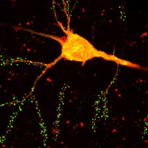 A cortical neuron labeled with monosynaptic rabies virus (orange).