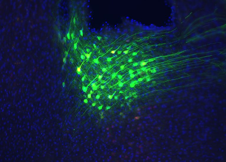 dACC neurons (green) in the mouse brain.