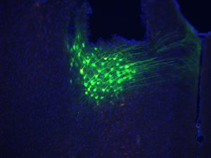 dACC neurons (green) in the mouse brain.