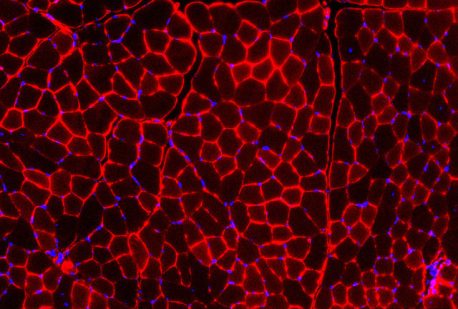 A cross-section of muscle tissue, showing muscle cells (red) and their nuclei (blue). 